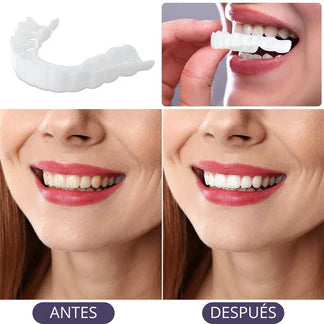 Denwhite® Carillas Dentales Ajustables - 2 Piezas (Superior e inferior)